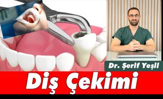 Diş Çekimi