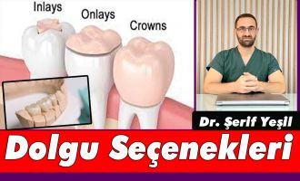 Dolgu Seçenekleri