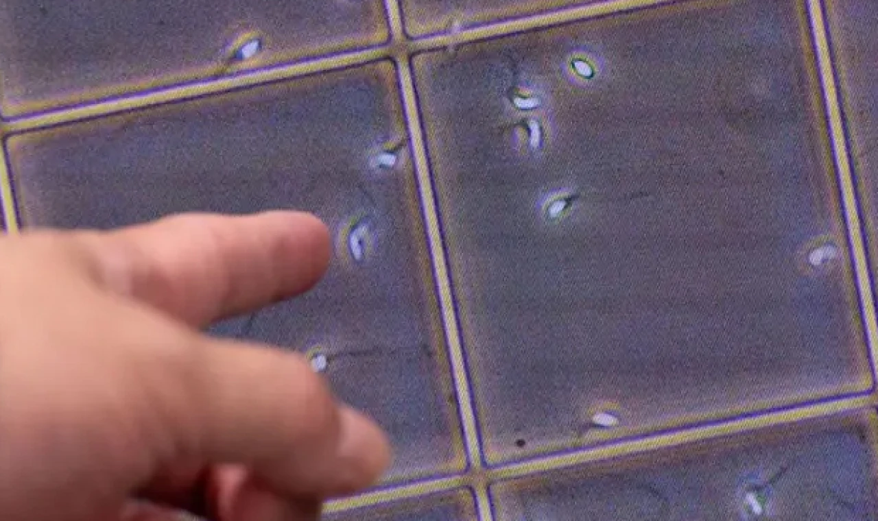 17 yıl sperm bağışladı, doğan bebeklerin 10'u kanser, bazıları öldü