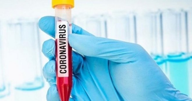 ‘365 test yapıldı, pozitif vaka yok’