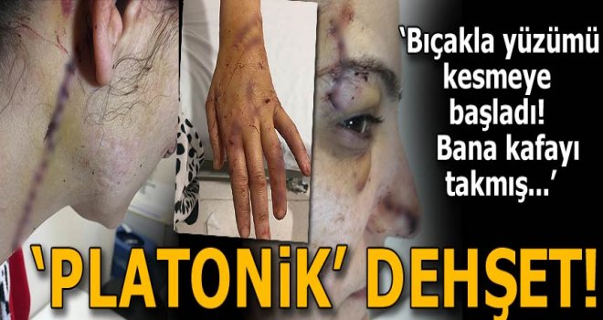 Adana'da platonik aşk dehşeti! 80 dikiş atıldı...