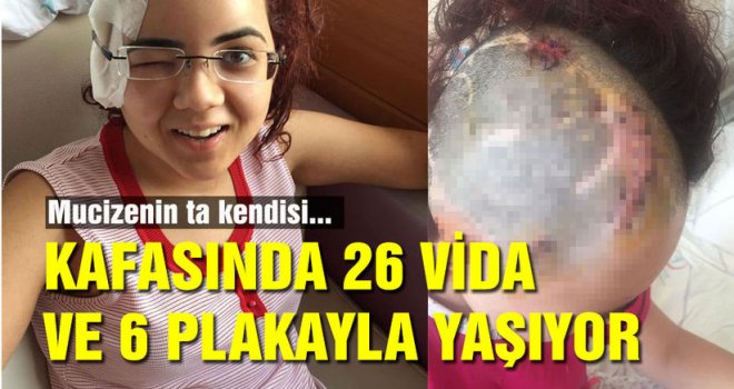 Azmiyle hayata tutunan Özge Karakuş 15 beyin ameliyatı geçirdi!