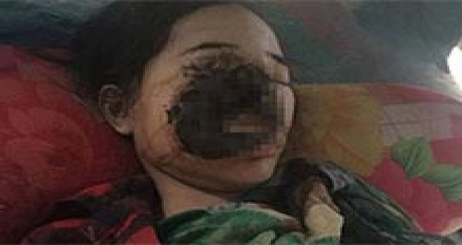 Dişini çektirmek isterken yüzünden oldu