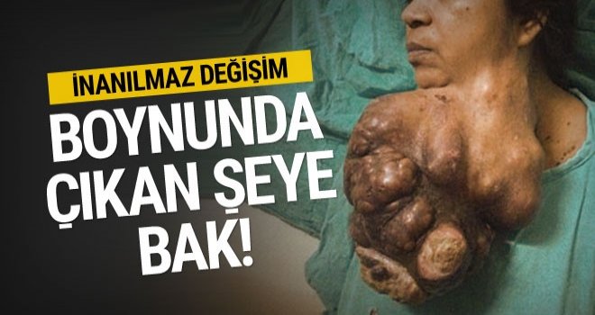 İnanılmaz değişim ikisi de aynı kadın
