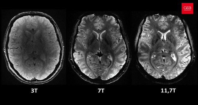 İnsan beyninin en güçlü MRI cihazıyla çekilen en net görüntüsü yayınlandı