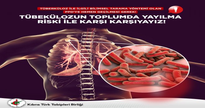Kıbrıs Türk Tabipleri Birliği: Verem taramasında PPD testi şart