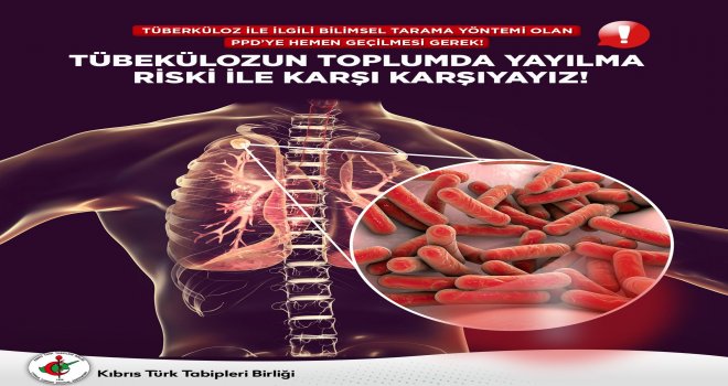 Kıbrıs Türk Tabipleri Birliği: Verem taramasında PPD testi şart