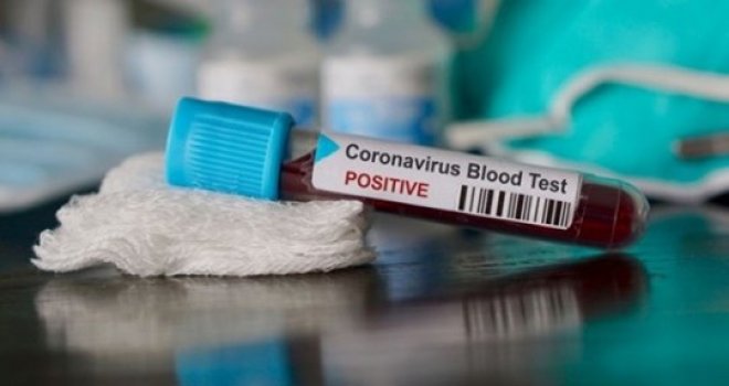 KKTC'de 5 yeni vaka daha...