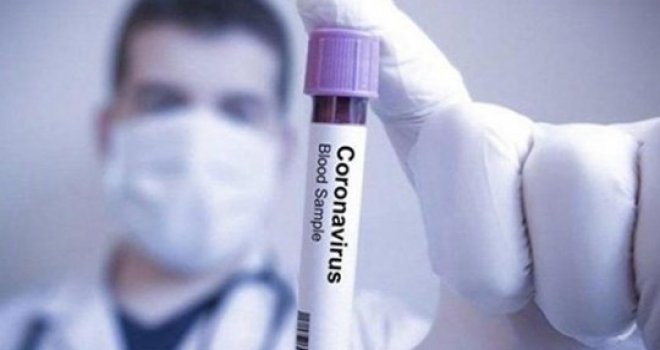 KKTC’de korona virüs vaka sayısı 64 oldu