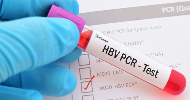 KKTC’nin 24 saatlik PCR testi talebinin BM’ye götürülmesini talep etti