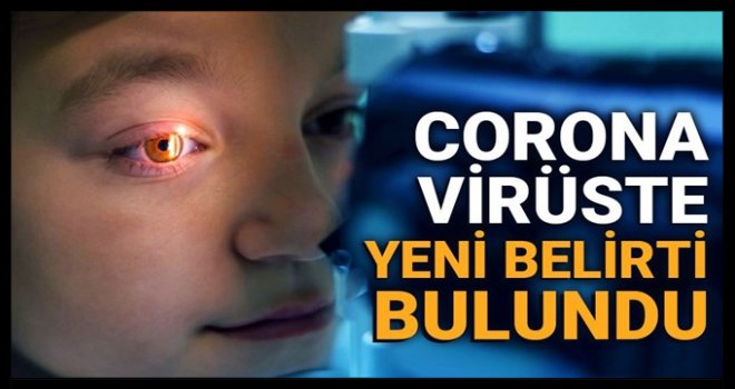 Konjonktivit nedir? Corona virüste yeni belirti bulundu