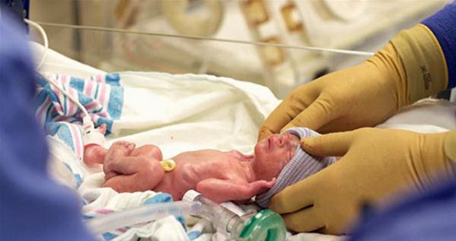 PREMATÜRE DOĞANLARIN ÇOCUK SAHİBİ OLMA ŞANSI AZALIYOR