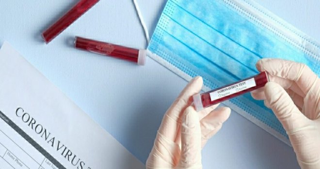 Rum tarafında 29 yeni, toplam 494 Kovid-19 vakası bulunuyor