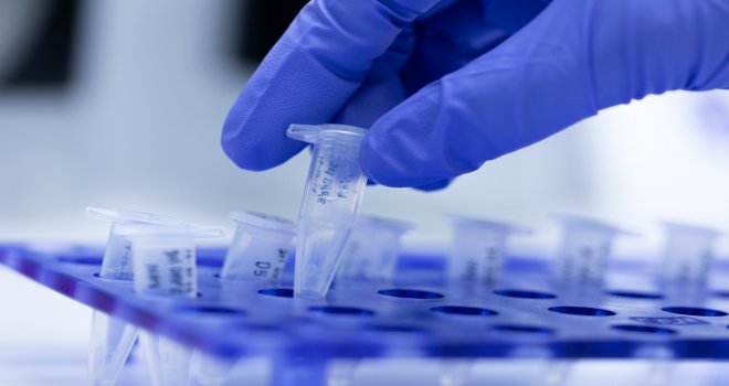 SAĞLIK BAKANLIĞI: GİRNE'DE ÜCRETSİZ PCR UYGULAMASI YAPACAK