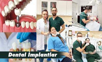 Dental İmplantlar