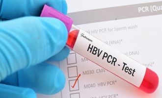 KKTC’nin 24 saatlik PCR testi talebinin BM’ye götürülmesini talep etti